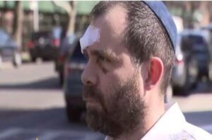 A victim of antisemitic attack in Brooklyn, N.Y. (Youtube/Screenshot)