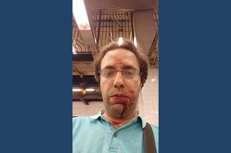 The Jewish man who was attacked on the NYC subway, July 2022.